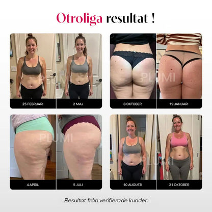 3D Plumi Leggings | Svart